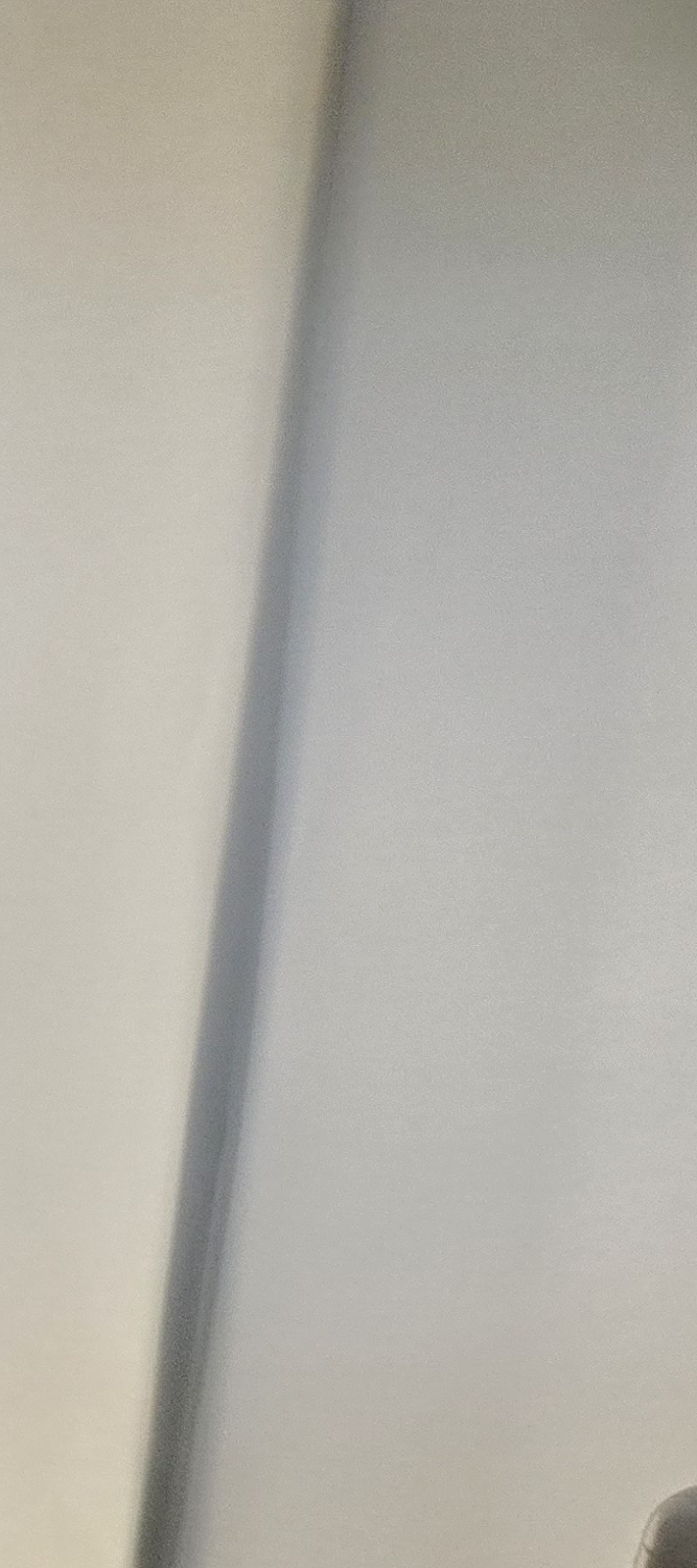 뼈이식 임플란트 수명 깐깐하게 파악하려면 관련 이미지 18