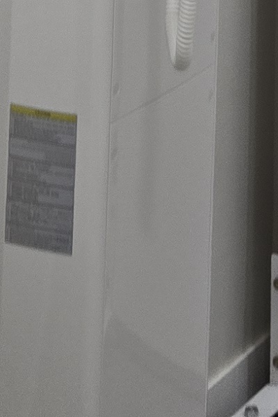 부정교합 교정 안하면 생기는 문제는 뭔가요 관련 이미지 53