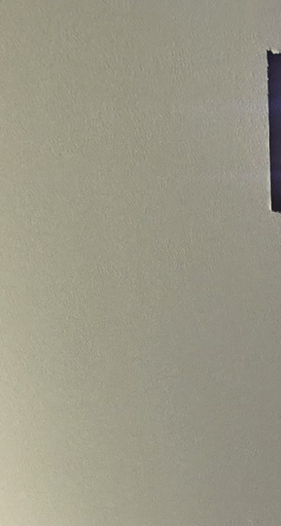 반대교합 치아교정 해결 가능할까 관련 이미지 9