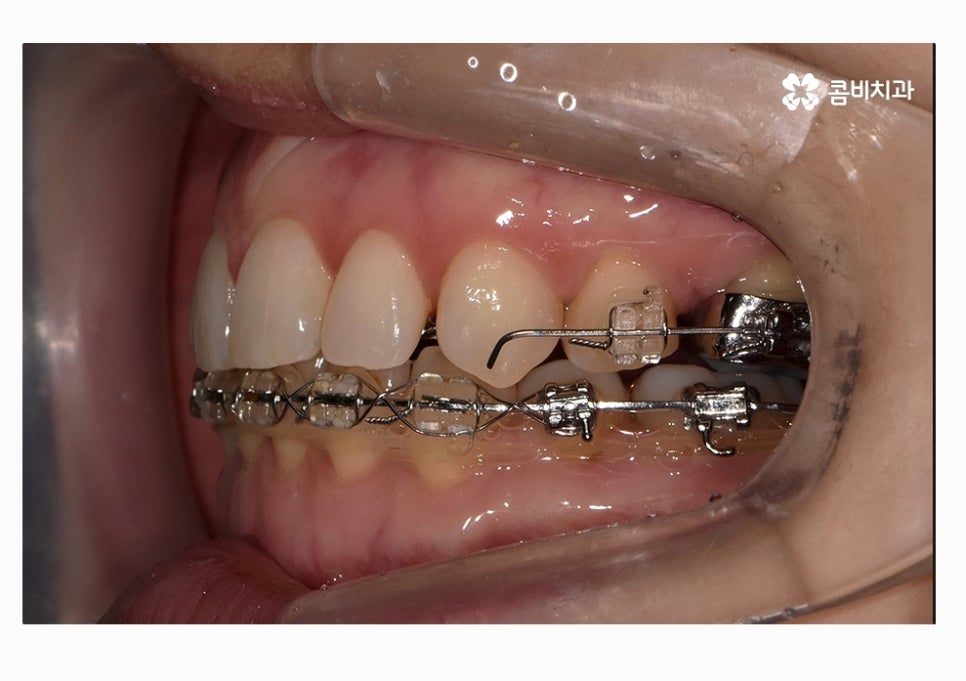 콤비교정 합리적으로 판단하려면 관련 이미지 13