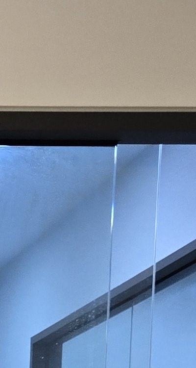 앞니 올세라믹 이건 알고 시작하세요 관련 이미지 17