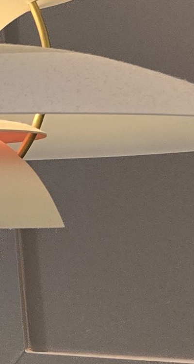 인레이 치료 후 통증 자꾸 심해지는데 괜찮은걸까 관련 이미지 39