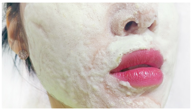 화이트헤드 제거 꿀팁공개! 관련 이미지 6