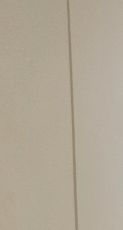 클리피씨교정 장단점 어떻게 비교하면 될까요 관련 이미지 12