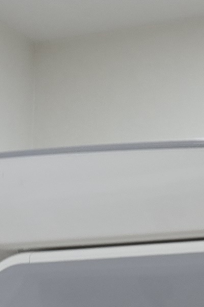 부정교합 교정 안하면 생기는 문제는 뭔가요 관련 이미지 24