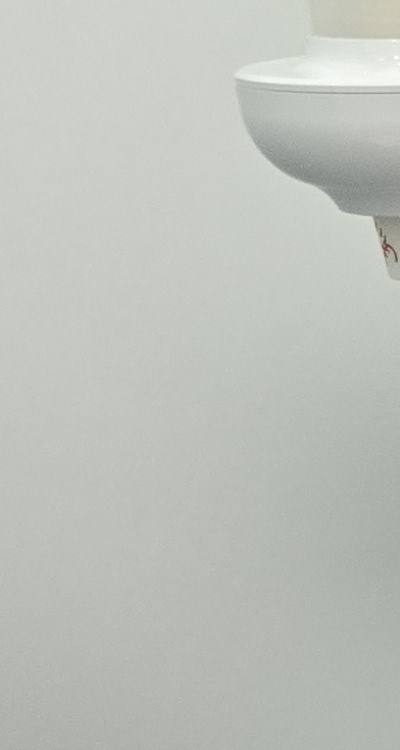 어금니 임플란트 안하면 후회하게 되는걸까 관련 이미지 15