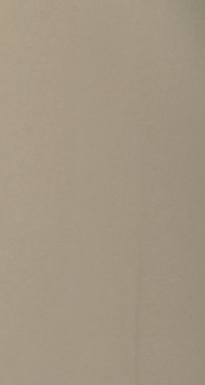 클리피씨교정 장단점 어떻게 비교하면 될까요 관련 이미지 19