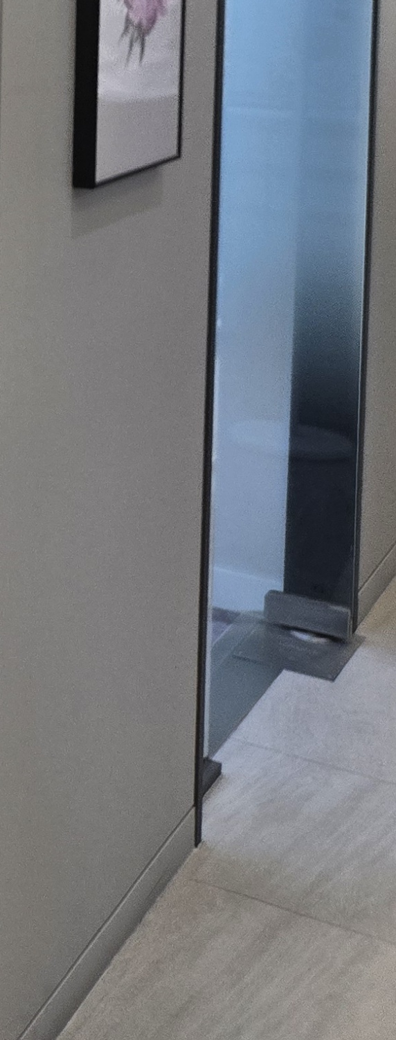 앞니 크라운 교체 깔끔하게 정리하려면 관련 이미지 42