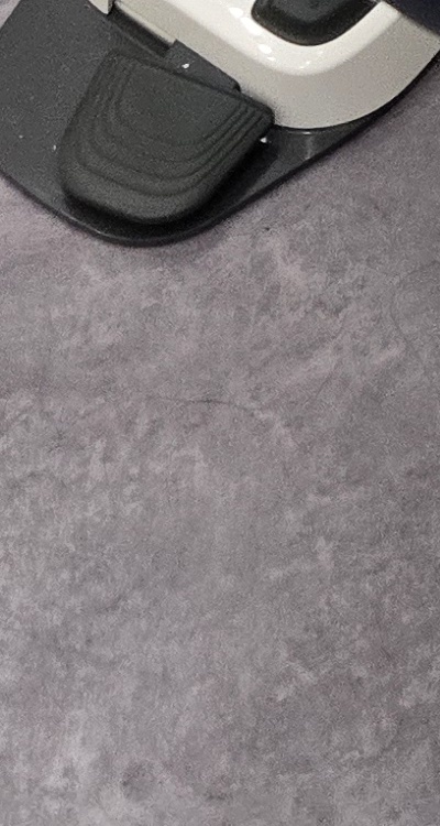 치아 사이 벌어짐 심해지는 이유부터 알아보면 관련 이미지 41