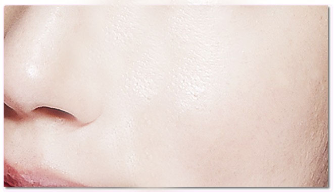 피부미백관리 하나로 끝! 관련 이미지 5