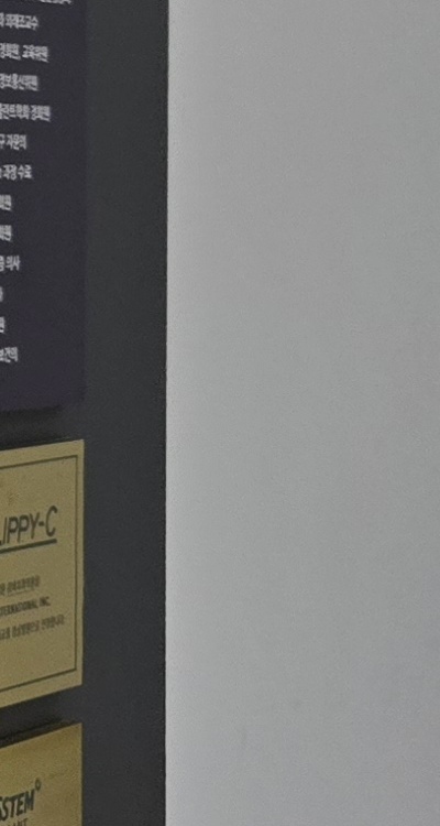 치아 발치 후 임플란트 언제부터 준비할까 관련 이미지 40