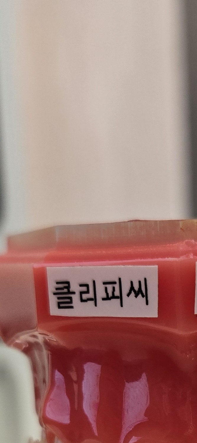 송곳니 덧니 발치 이럴때 해당되네요 관련 이미지 26