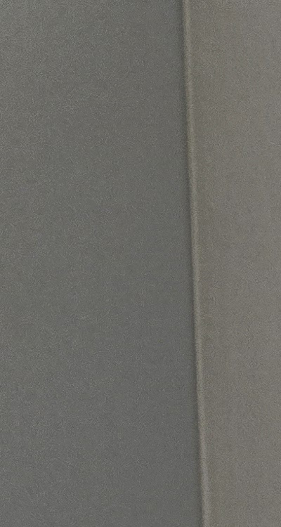 앞니 틀어짐 교정 조화롭게 마무리하려면 관련 이미지 11