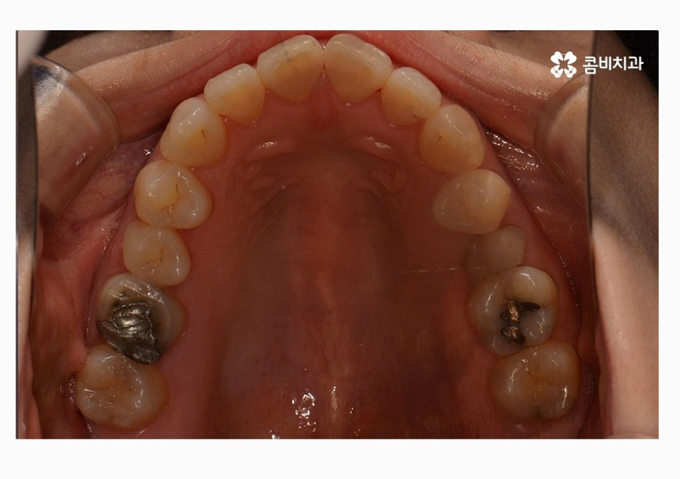 콤비교정 합리적으로 판단하려면 관련 이미지 6