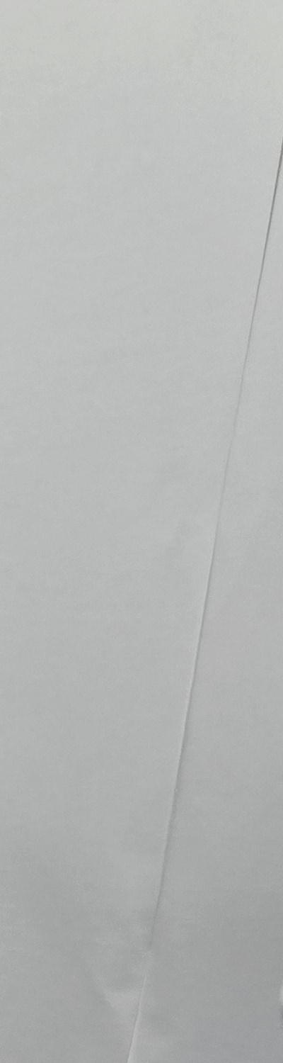 치과 치아미백 효과 어떤식으로 나타날까 관련 이미지 17