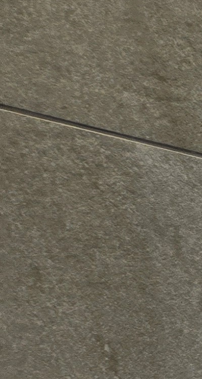 앞니 신경치료 크라운 까지 해야할 상황이라면 관련 이미지 21