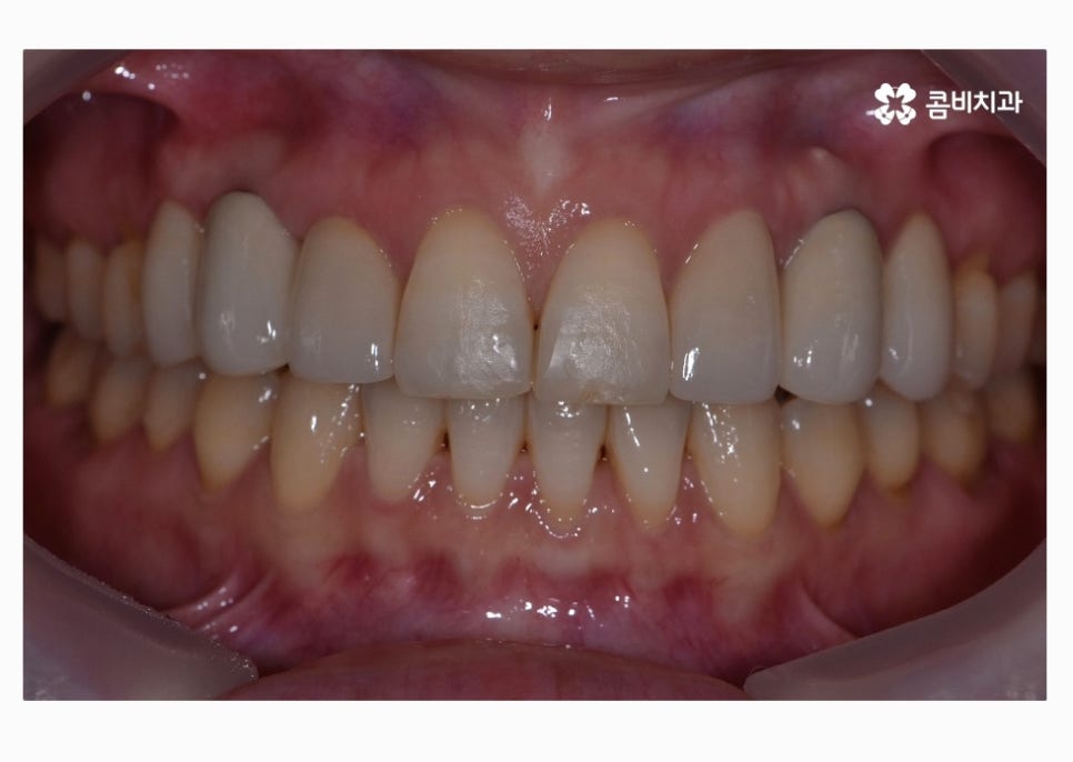 30대임플란트 향후 미래를 바라본다면 관련 이미지 12