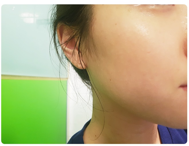 가을철피부관리 한방에 끝내기 관련 이미지 8