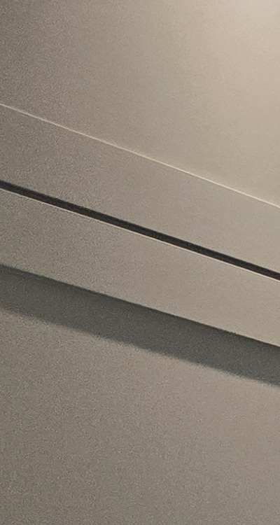 아래 사랑니 발치 통증 미리 알고 대처하려면 관련 이미지 10