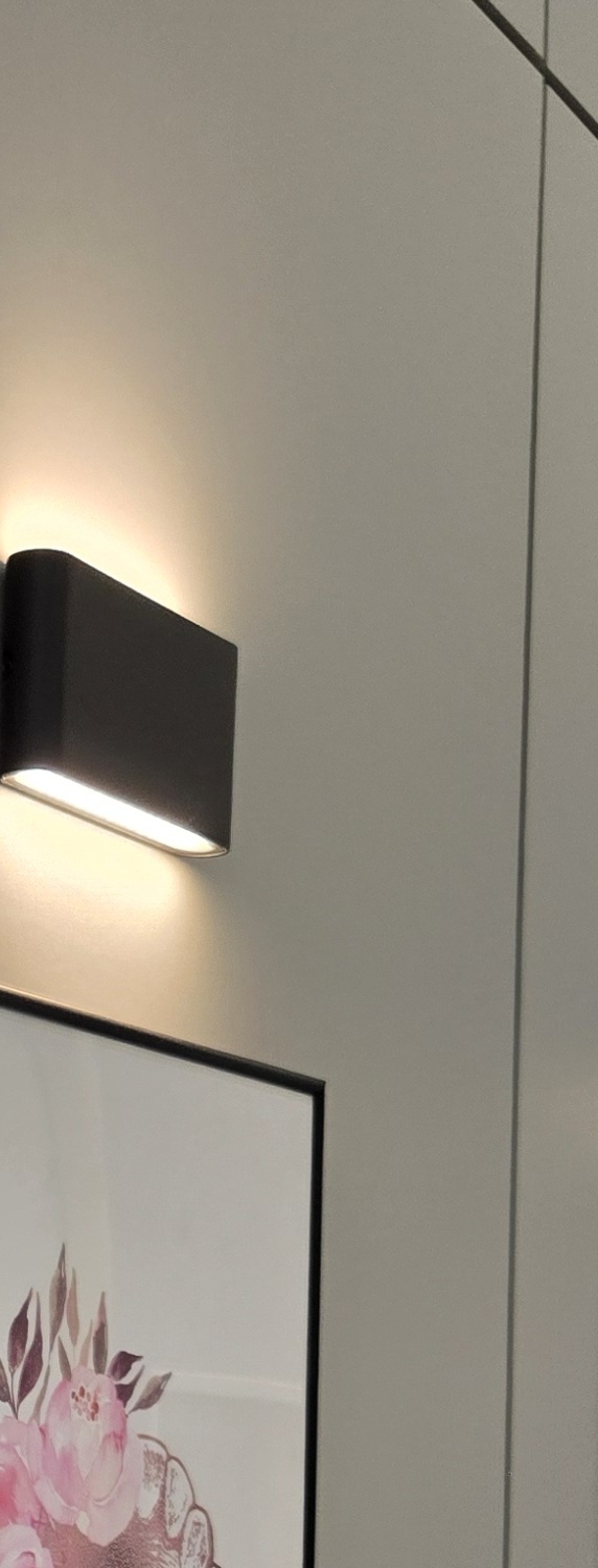 비발치 돌출입 교정 어떨때 적절할까 관련 이미지 26