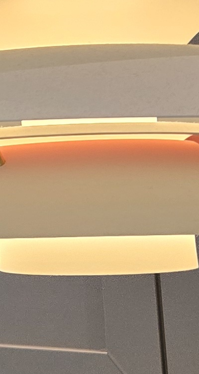 인레이 치료 후 통증 자꾸 심해지는데 괜찮은걸까 관련 이미지 38