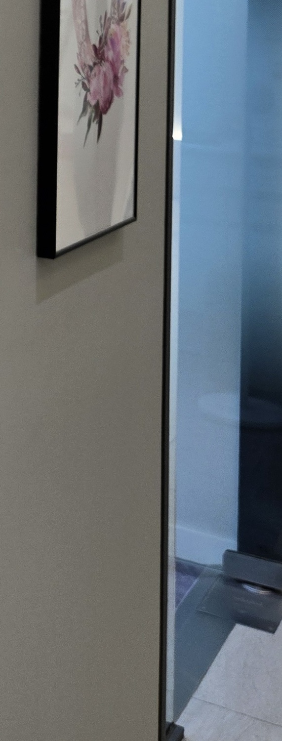 비발치 돌출입 교정 어떨때 적절할까 관련 이미지 34