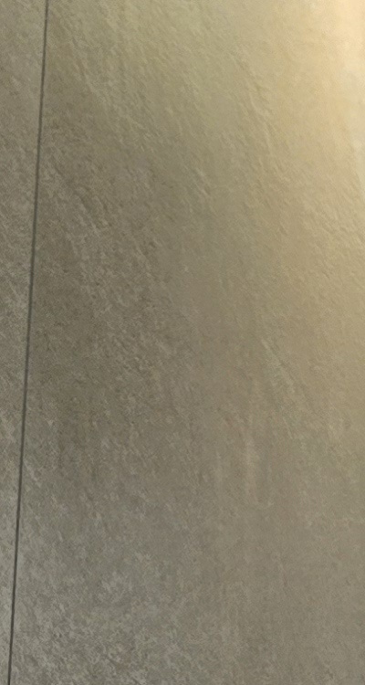 앞니 신경치료 크라운 까지 해야할 상황이라면 관련 이미지 16