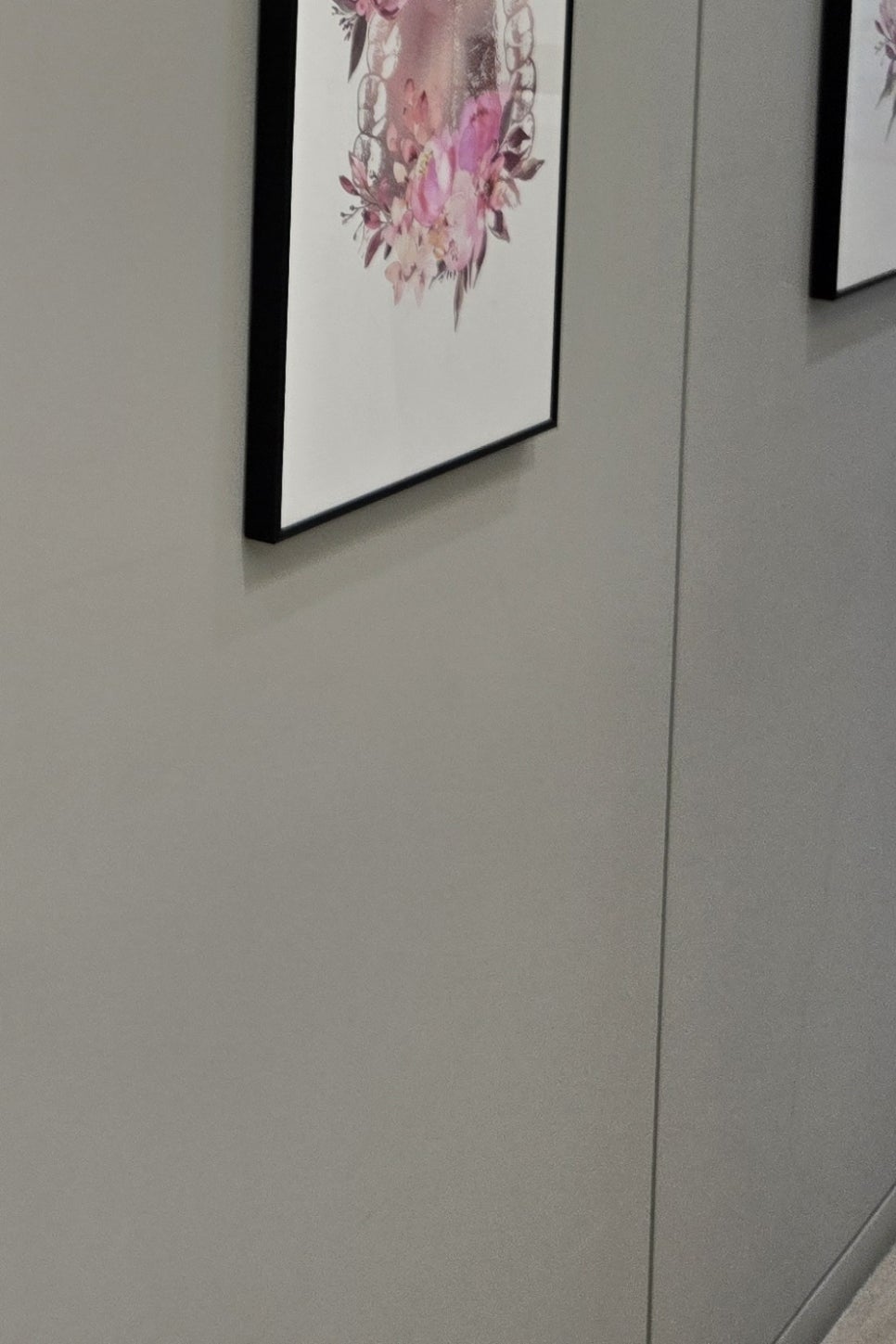 부분매복 사랑니 발치 신중하게 대비하려면 관련 이미지 29