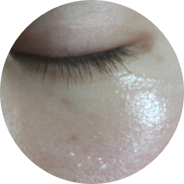 눈가주름 개선이 필요할때 환해지는 메조필라 아이세럼^^ 관련 이미지 13