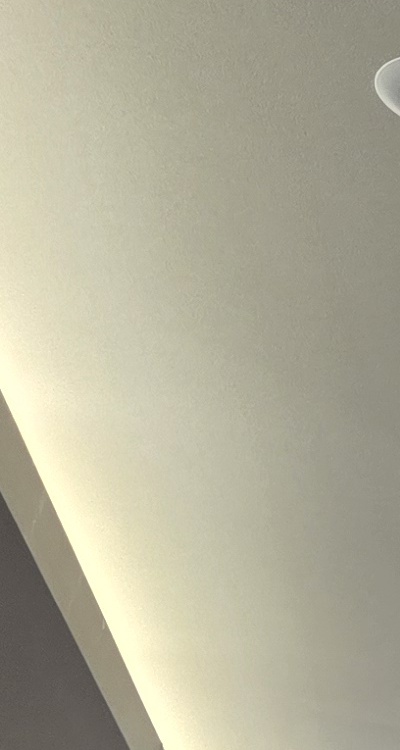 반대교합 치아교정 해결 가능할까 관련 이미지 19