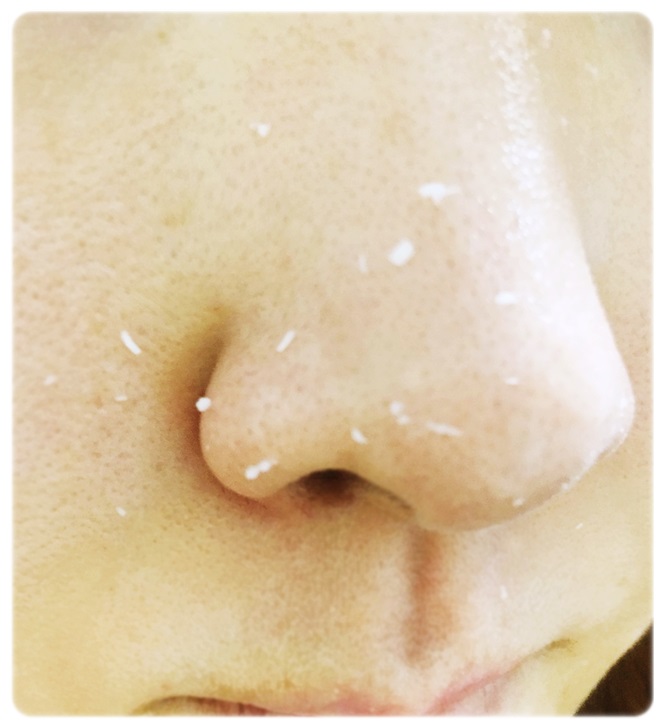 지성피부클렌징 꿀팁! 사우나광패드 관련 이미지 7