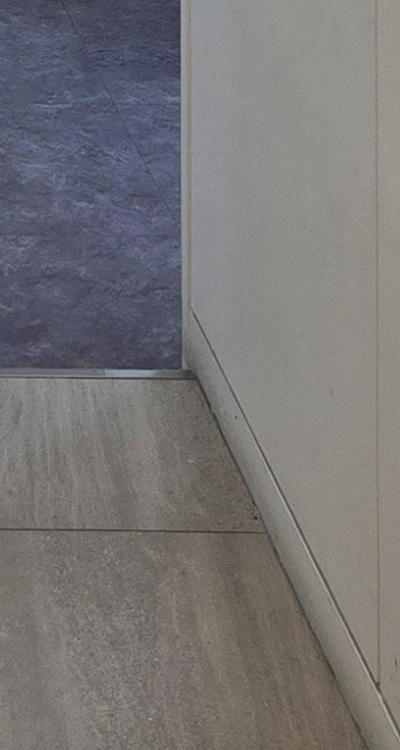 클리피씨교정 장단점 어떻게 비교하면 될까요 관련 이미지 46