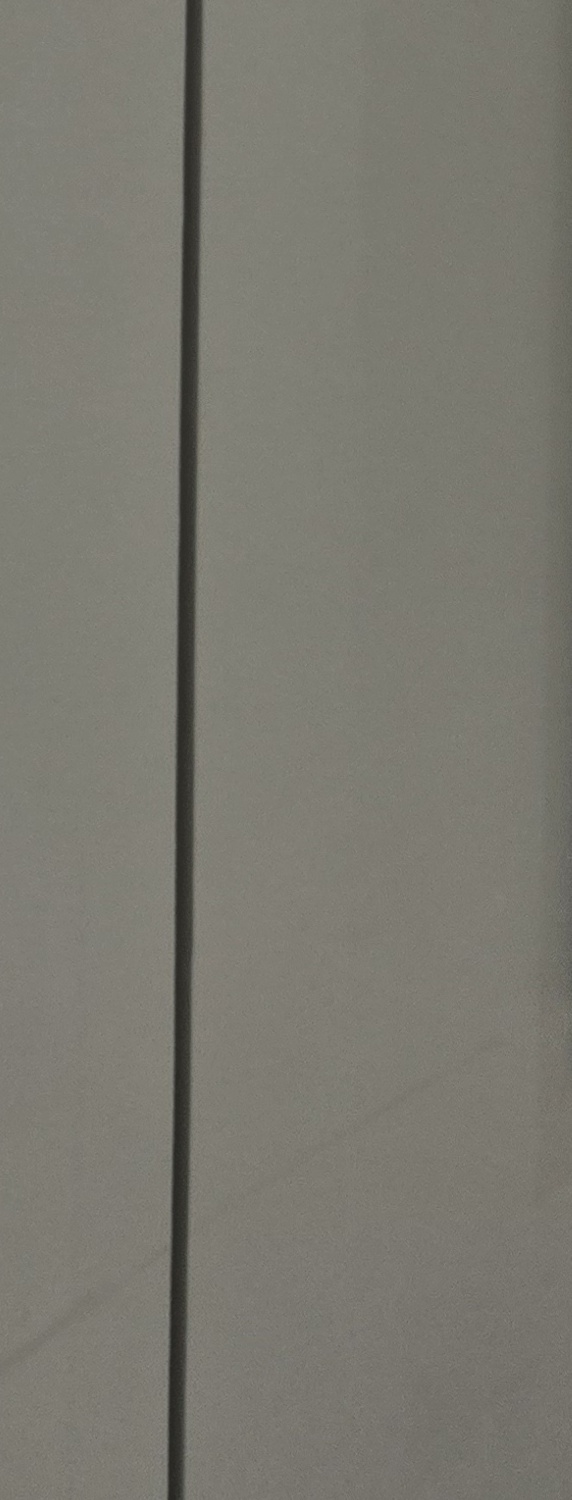 충치 치아 깨짐 시점이 관건이라면 관련 이미지 22