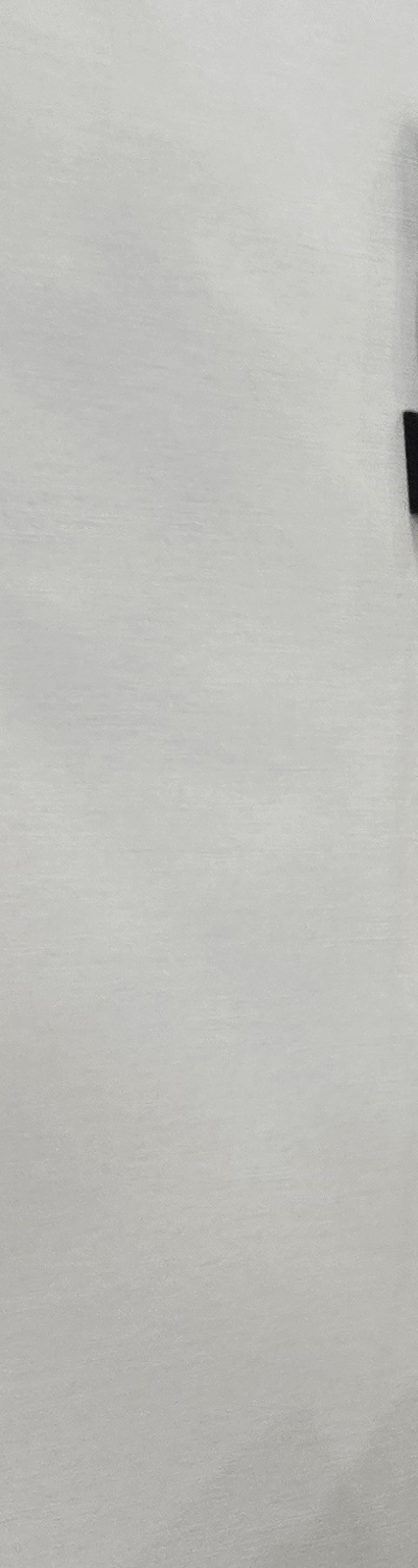 치과 치아미백 효과 어떤식으로 나타날까 관련 이미지 11