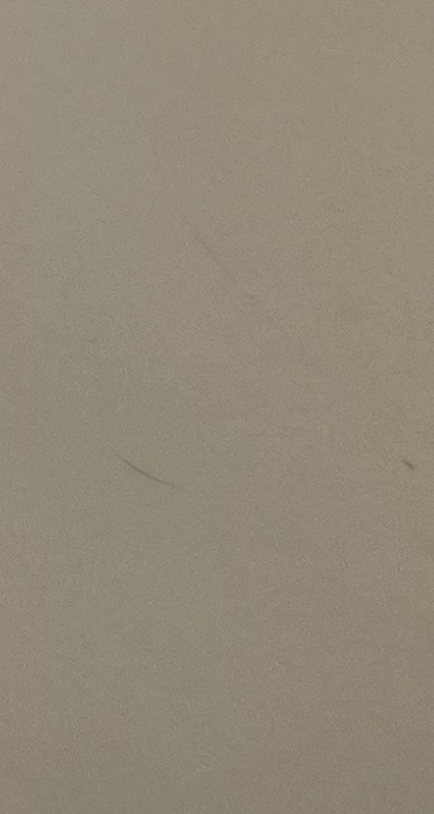 클리피씨교정 장단점 어떻게 비교하면 될까요 관련 이미지 48