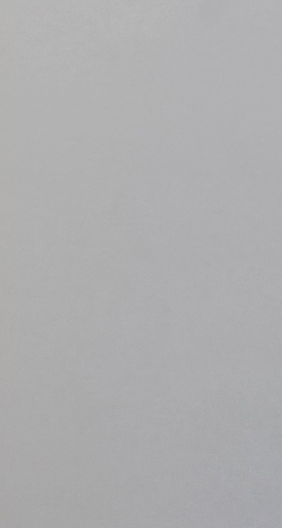 앞니 부분 교정 간단하니까 좋은건가요 관련 이미지 39