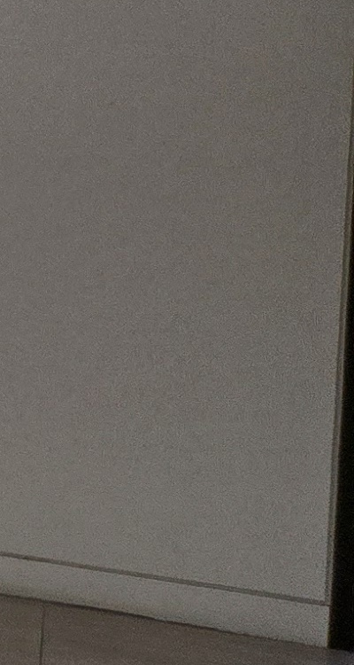 앞니 틀어짐 교정 조화롭게 마무리하려면 관련 이미지 38