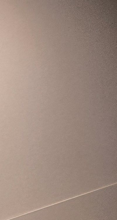 인레이 치료 후 통증 자꾸 심해지는데 괜찮은걸까 관련 이미지 21