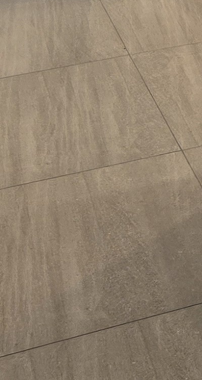 앞니 부분 교정 간단하니까 좋은건가요 관련 이미지 46