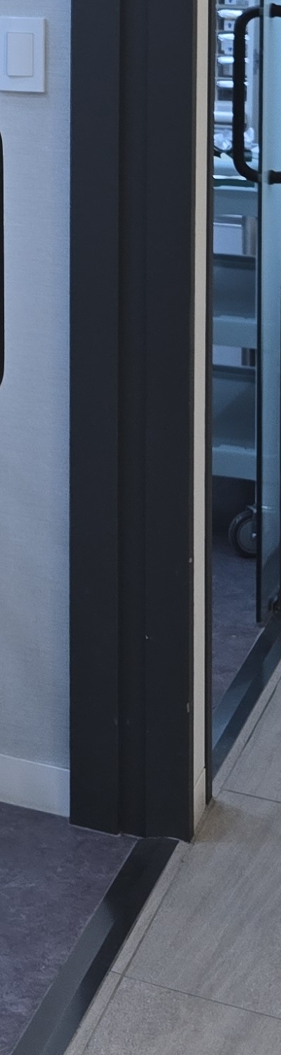 어금니 없으면 얼굴 발음에 어느정도나 안좋을까 관련 이미지 31