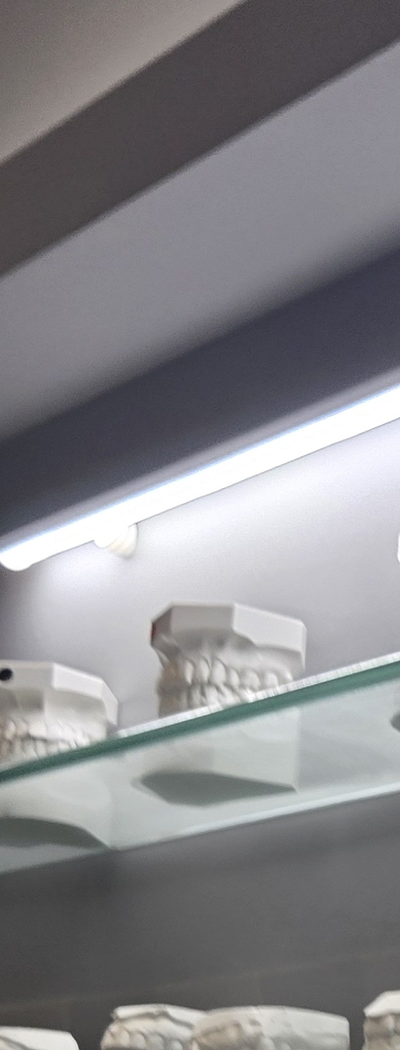 치과 치아미백 효과 어떤식으로 나타날까 관련 이미지 32