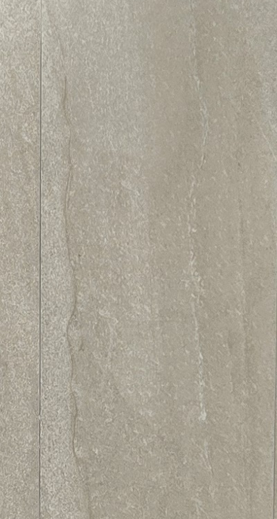 임플란트의 장점 할까 말까 고민이신 분들을 위한 정리 관련 이미지 25