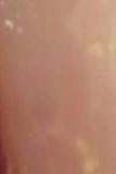 어금니 임플란트 수명 어느정도나 지속될까 관련 이미지 31