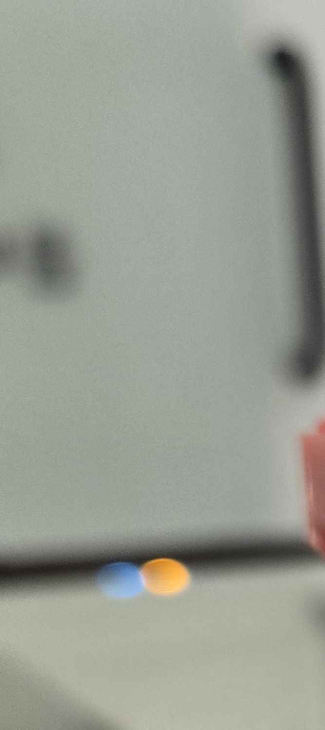 송곳니 덧니 발치 이럴때 해당되네요 관련 이미지 25