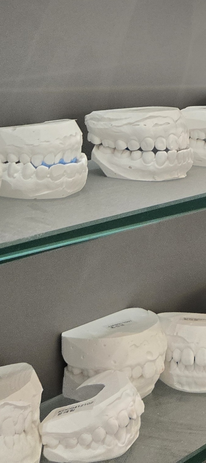 오래된 보철물 아말감 교체 어떠한 케이스일까 관련 이미지 18