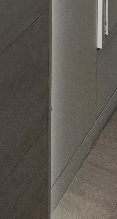 앞니 틀어짐 교정 조화롭게 마무리하려면 관련 이미지 45