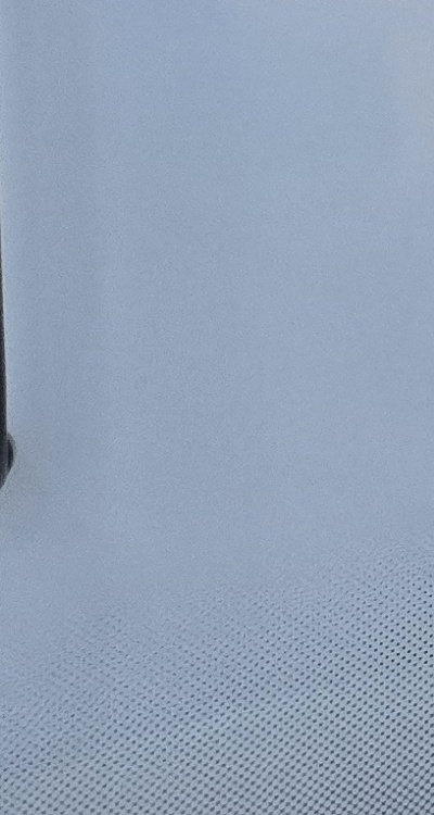 사랑니 발치 후 충치 치료 둘다 준비하려면 관련 이미지 42