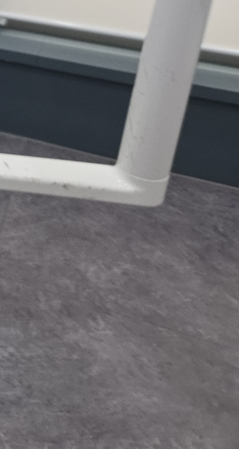 어금니 임플란트 뼈이식 이럴때 해당됩니다 관련 이미지 20