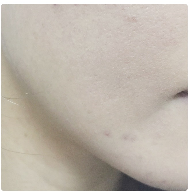 커버력 좋은 파운데이션 추천 피부 고민 해결! 관련 이미지 8