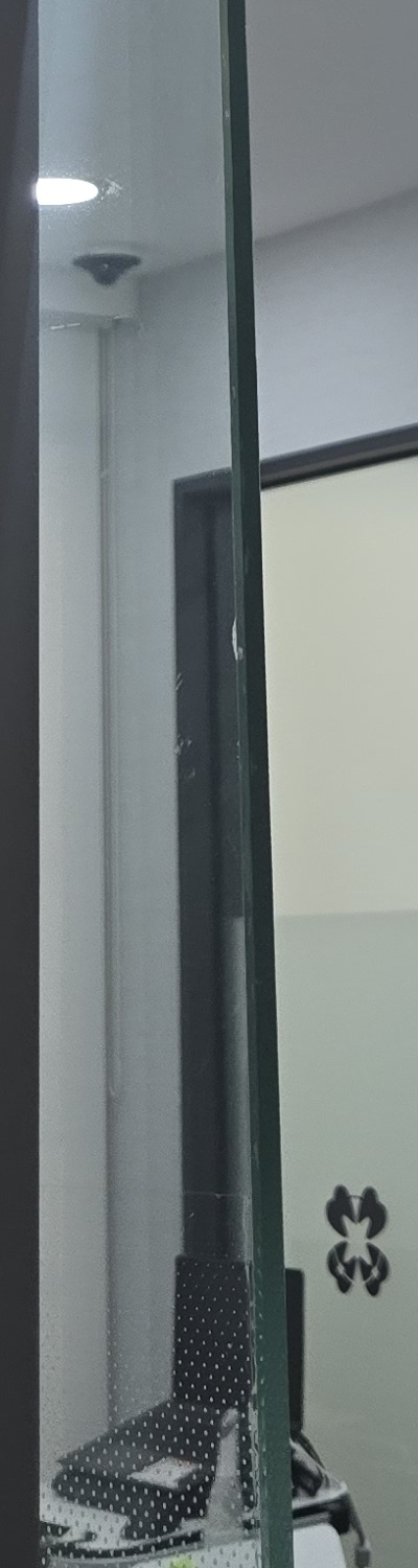 앞니 크라운 교체 깔끔하게 정리하려면 관련 이미지 23